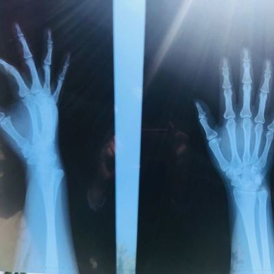 Timeline: Incidente Elvia Marisol