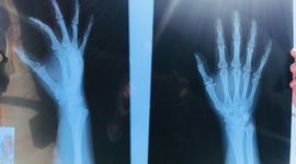 Timeline: Incidente Elvia Marisol