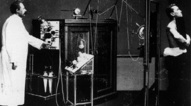 Timeline: Evolución de la radiología