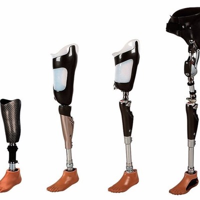 Timeline: Historia y Evolución de la Prótesis