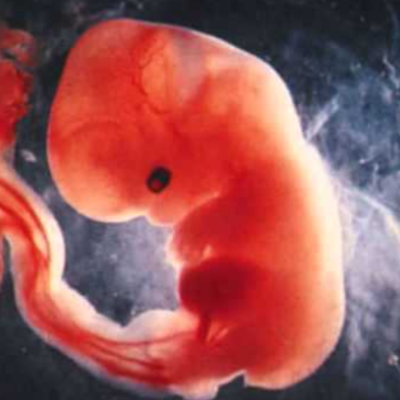 Timeline: Pregnancy Timeline