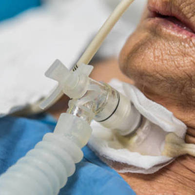 Timeline: Historia de la Traqueostomia