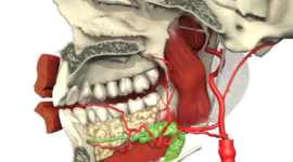 Timeline: Epistaxis posterior