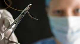 Timeline: Historia  de las Suturas