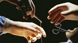 Timeline: Historia de la cirugía