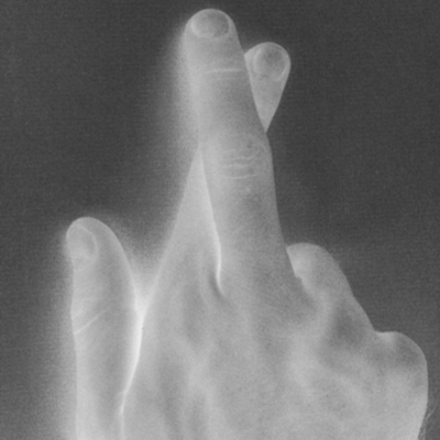 Timeline: To Lie or Not to Lie...