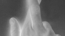 Timeline: To Lie or Not to Lie...