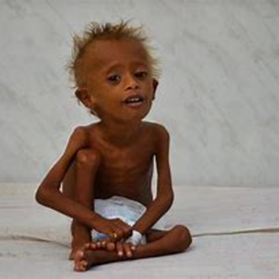 Timeline: Yemen Famine