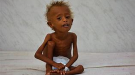 Timeline: Yemen Famine