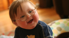 Timeline: perros pug