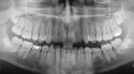 Timeline: The History of Dentistry
