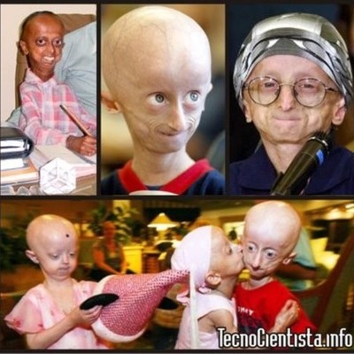 Timeline: Sindromes Por Alteraciones Cromosómicas