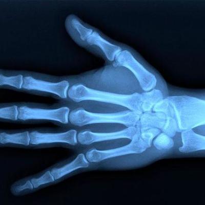 Timeline: История происхождения рентгена