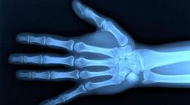 Timeline: История происхождения рентгена