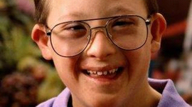 Timeline: Sindromes Por Alteraciones Cromosómicas