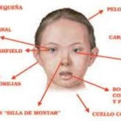 Timeline: síndromes por alteraciones en el adn