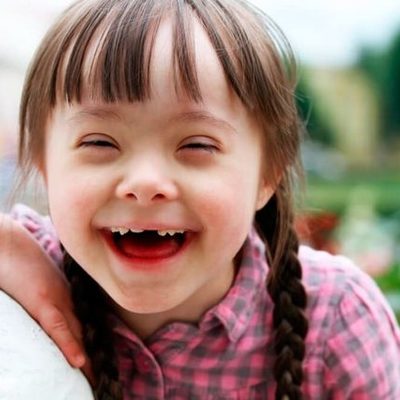 Timeline: Sindrome de down