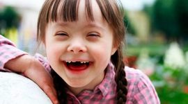 Timeline: Sindrome de down