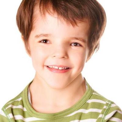 Timeline: Sindrome de  turner