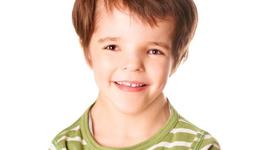 Timeline: Sindrome de  turner