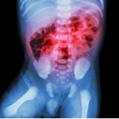 Timeline: Perspectiva histórica de la EN