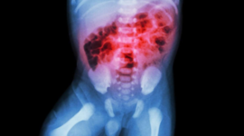 Timeline: Perspectiva histórica de la EN