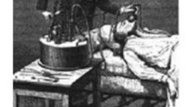 Timeline: Historia del tratamiento del dolor