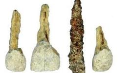 Timeline: History of Odontology