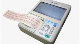 Timeline: électrocardiographe
