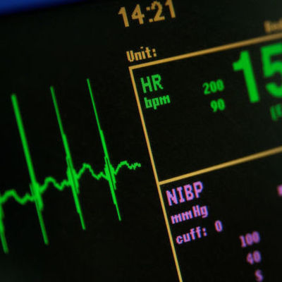 Timeline: Frise de l'évolution des appareils médical