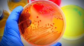 Timeline: Microbiología