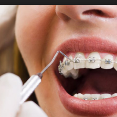 Timeline: the evolution of orthodontics