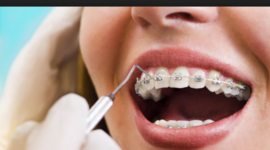 Timeline: the evolution of orthodontics