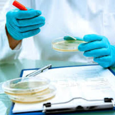 Timeline: HISTORIA DE LA MICROBIOLOGIA