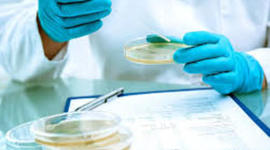 Timeline: HISTORIA DE LA MICROBIOLOGIA