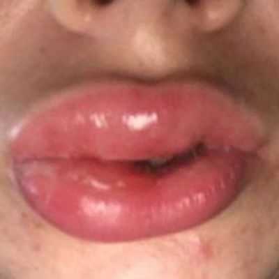 Timeline: Immune System Timeline