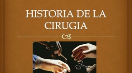 Timeline: Historia de la cirugia