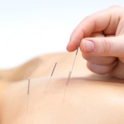 Timeline: Medicina alternativa y Terapias complementarias