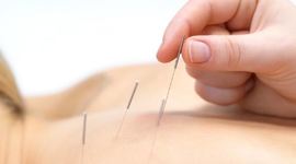 Timeline: Medicina alternativa y Terapias complementarias