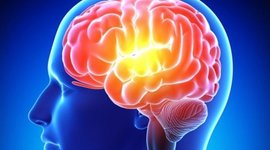 Timeline: Intervención Neuropsicológica