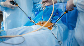 Timeline: Historia laparoscopia y endoscopia