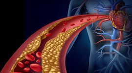 Timeline: Aterosclerosis