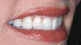 Timeline: AndrewS Timeline Of My Future