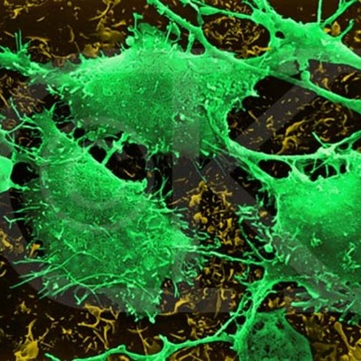 Timeline: Cancer Screenings