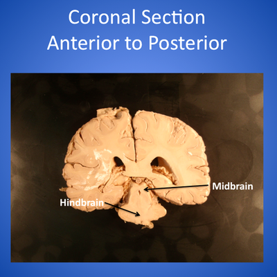 Timeline: EDM310 timeline