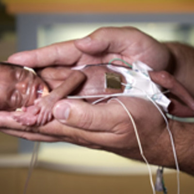 Timeline: The History of Neonatal Intensive Care Units
