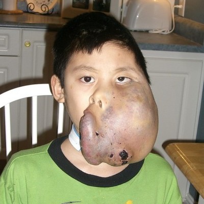 Timeline: Son Pham's Progress