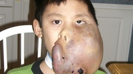 Timeline: Son Pham's Progress