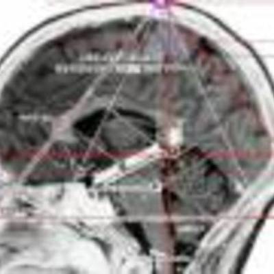 Timeline: Transactional Model of Development