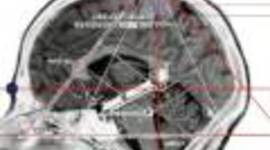 Timeline: Transactional Model of Development